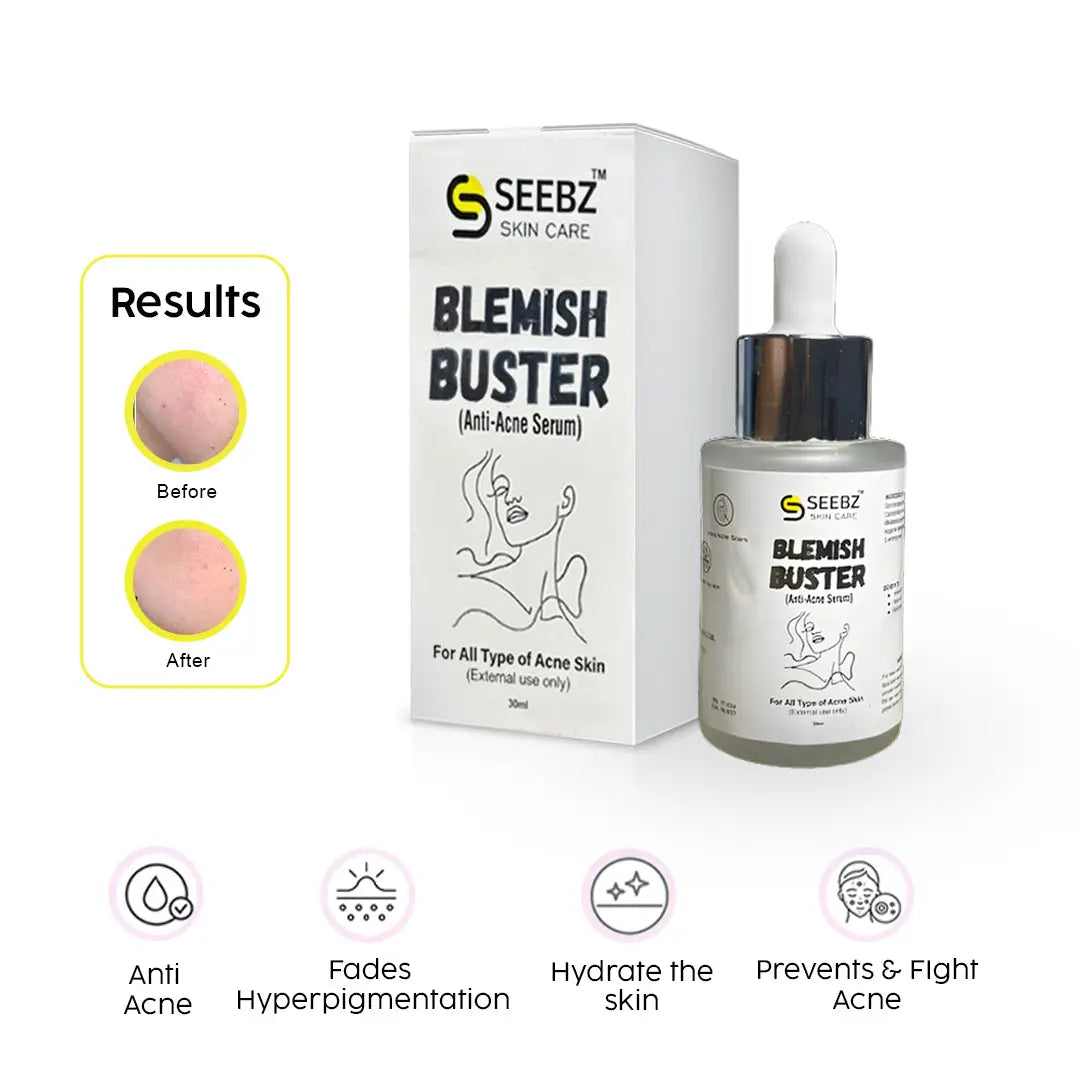 Blemish Buster-Anti Acne Seebz.pk